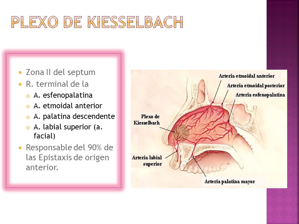 Plexo de Kiesselbach Zona II del septum R. terminal de la