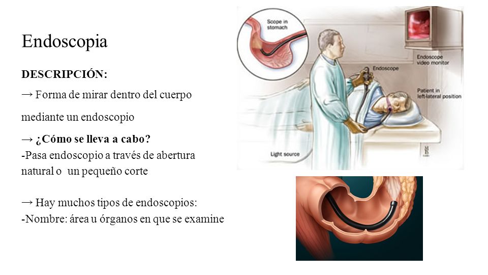 Endoscopia DESCRIPCIÓN: → Forma de mirar dentro del cuerpo