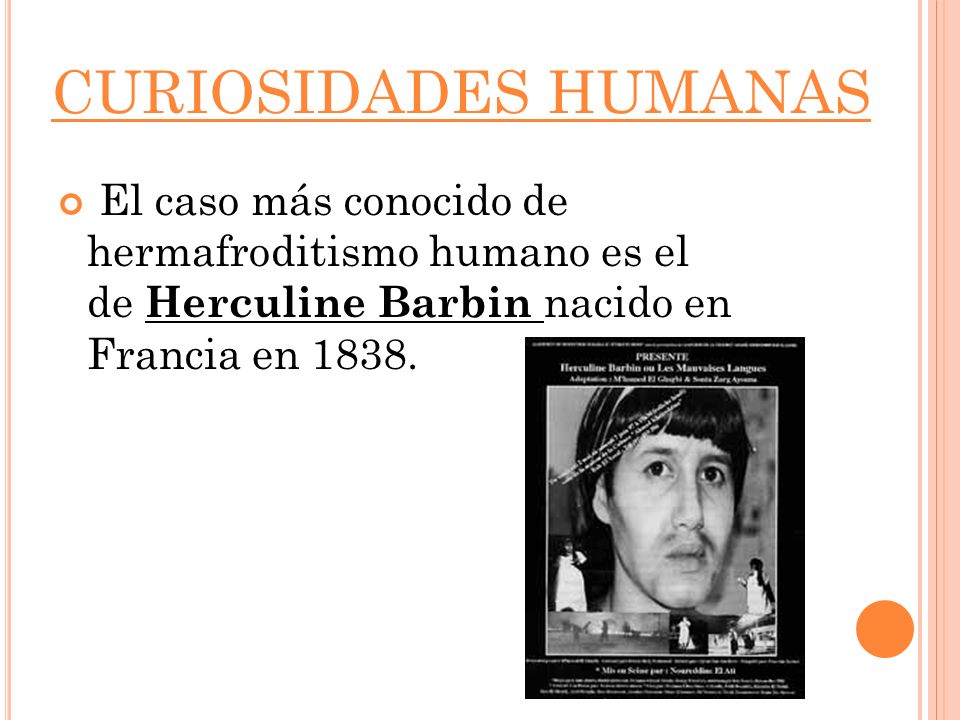 CURIOSIDADES HUMANAS El caso más conocido de hermafroditismo humano es el de Herculine Barbin nacido en Francia en