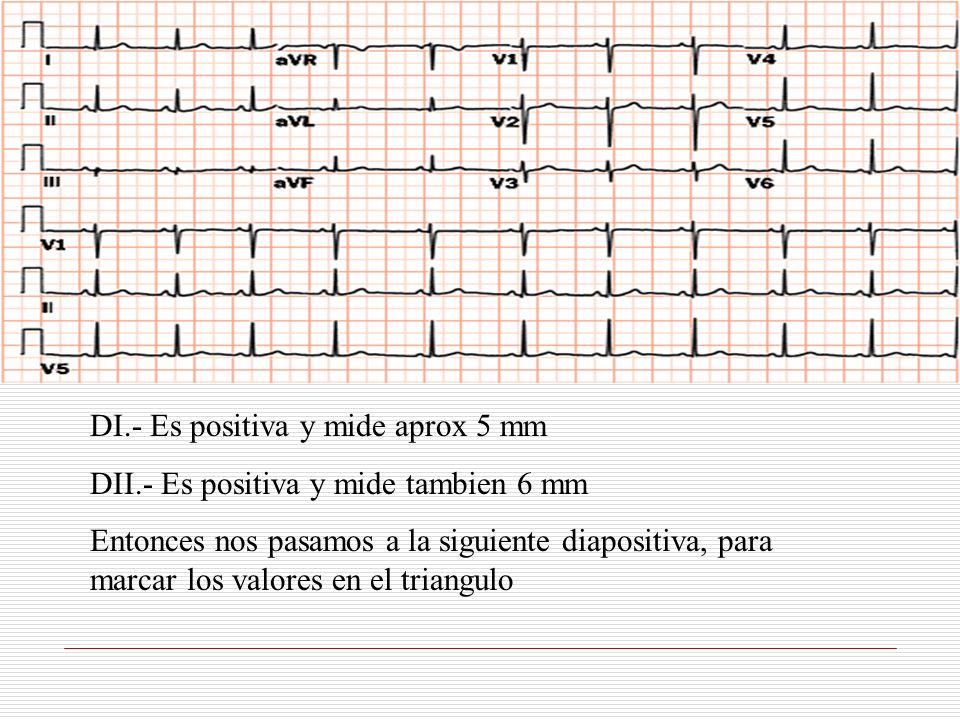 DI.- Es positiva y mide aprox 5 mm