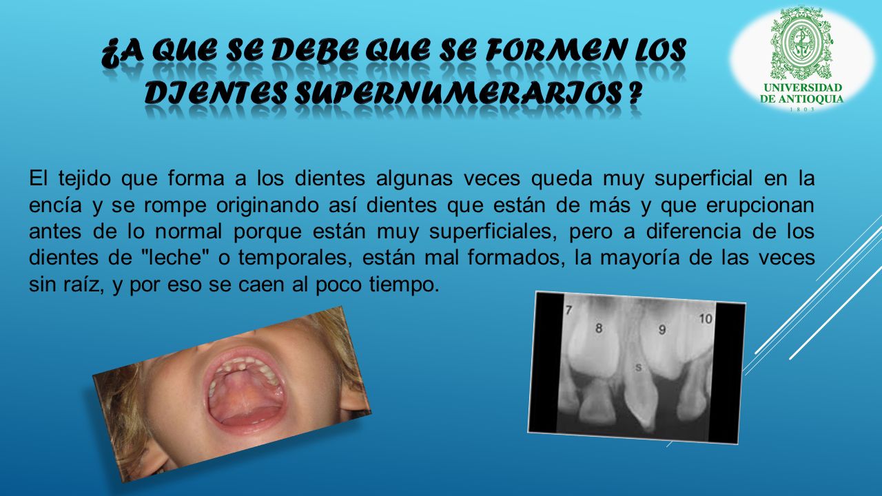 ¿A QUE SE DEBE QUE SE FORMEN LOS DIENTES SUPERNUMERARIOS