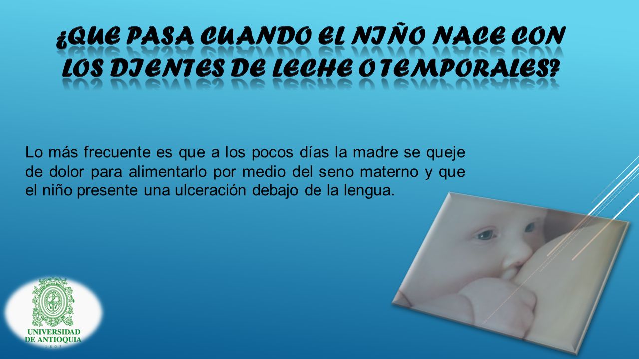 ¿QUE PASA CUANDO EL NIÑO NACE CON LOS DIENTES DE LECHE O TEMPORALES