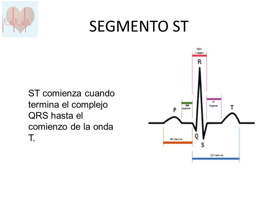 SEGMENTO ST ST comienza cuando termina el complejo QRS hasta el comienzo de la onda T.