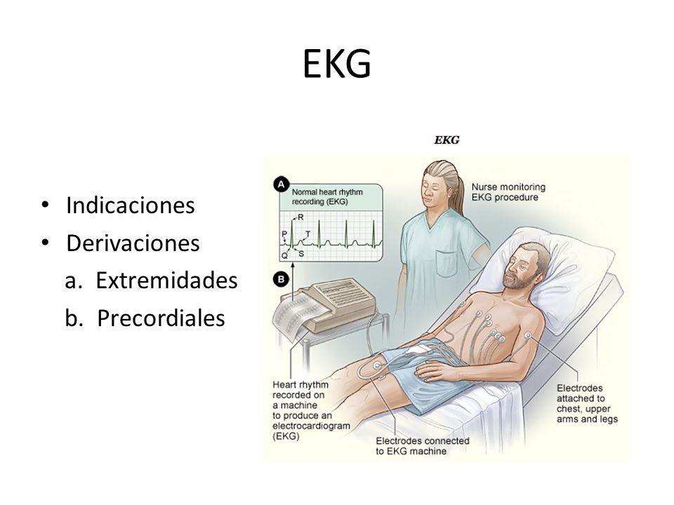 EKG Indicaciones Derivaciones a. Extremidades b. Precordiales