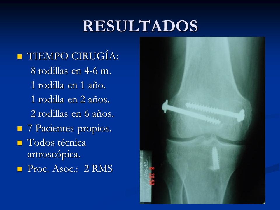 RESULTADOS TIEMPO CIRUGÍA: 8 rodillas en 4-6 m. 1 rodilla en 1 año.