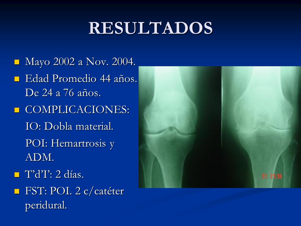 RESULTADOS Mayo 2002 a Nov Edad Promedio 44 años. De 24 a 76 años. COMPLICACIONES: IO: Dobla material.