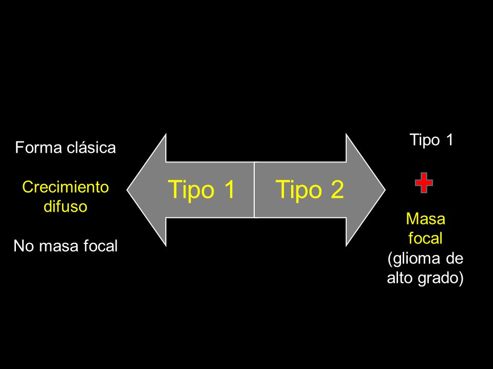 Tipo 1 Forma clásica Crecimiento difuso Masa focal No masa focal