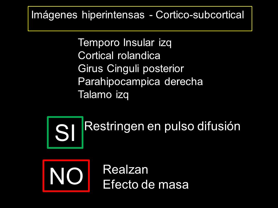 SI NO Restringen en pulso difusión Realzan Efecto de masa