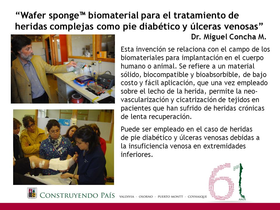 Wafer sponge™ biomaterial para el tratamiento de heridas complejas como pie diabético y úlceras venosas