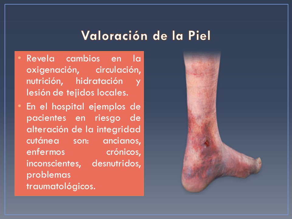 Valoración de la Piel Revela cambios en la oxigenación, circulación, nutrición, hidratación y lesión de tejidos locales.