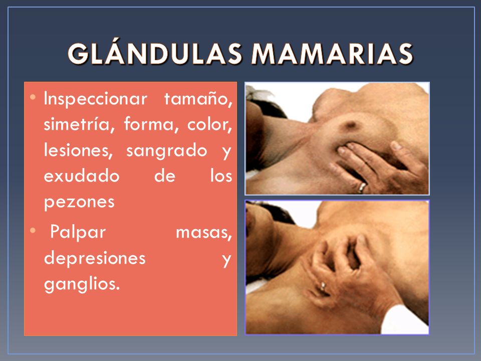 GLÁNDULAS MAMARIAS Inspeccionar tamaño, simetría, forma, color, lesiones, sangrado y exudado de los pezones.