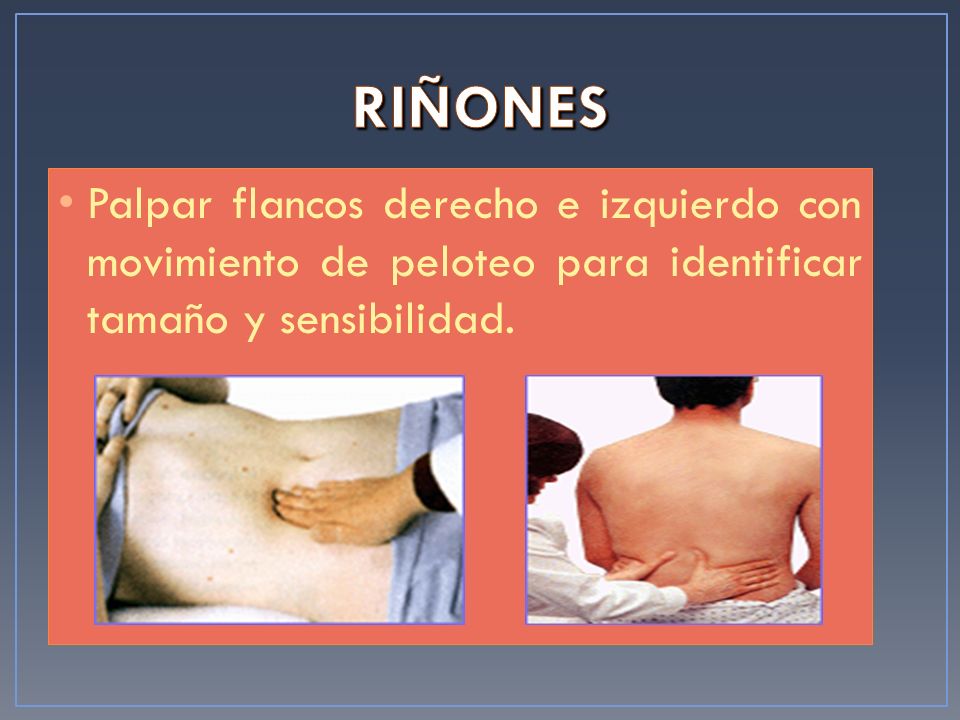 RIÑONES Palpar flancos derecho e izquierdo con movimiento de peloteo para identificar tamaño y sensibilidad.