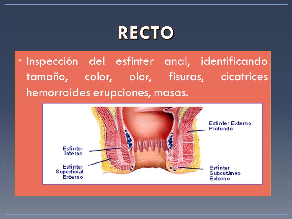 RECTO Inspección del esfínter anal, identificando tamaño, color, olor, fisuras, cicatrices hemorroides erupciones, masas.