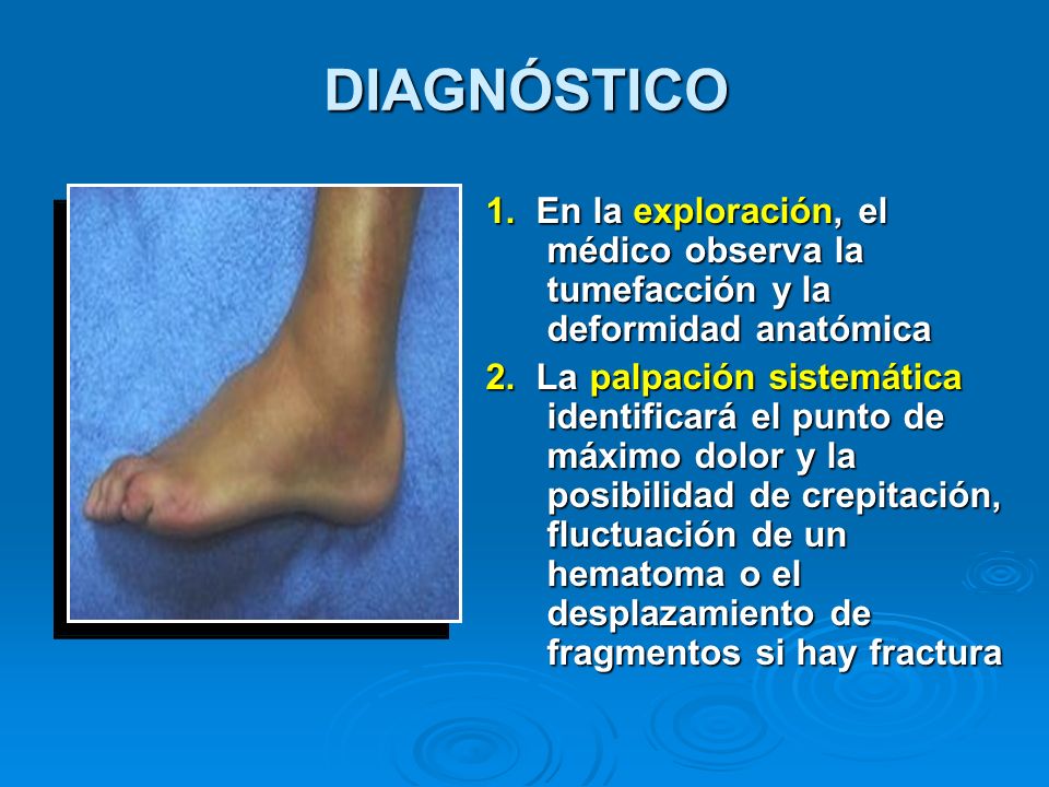 DIAGNÓSTICO 1. En la exploración, el médico observa la tumefacción y la deformidad anatómica.