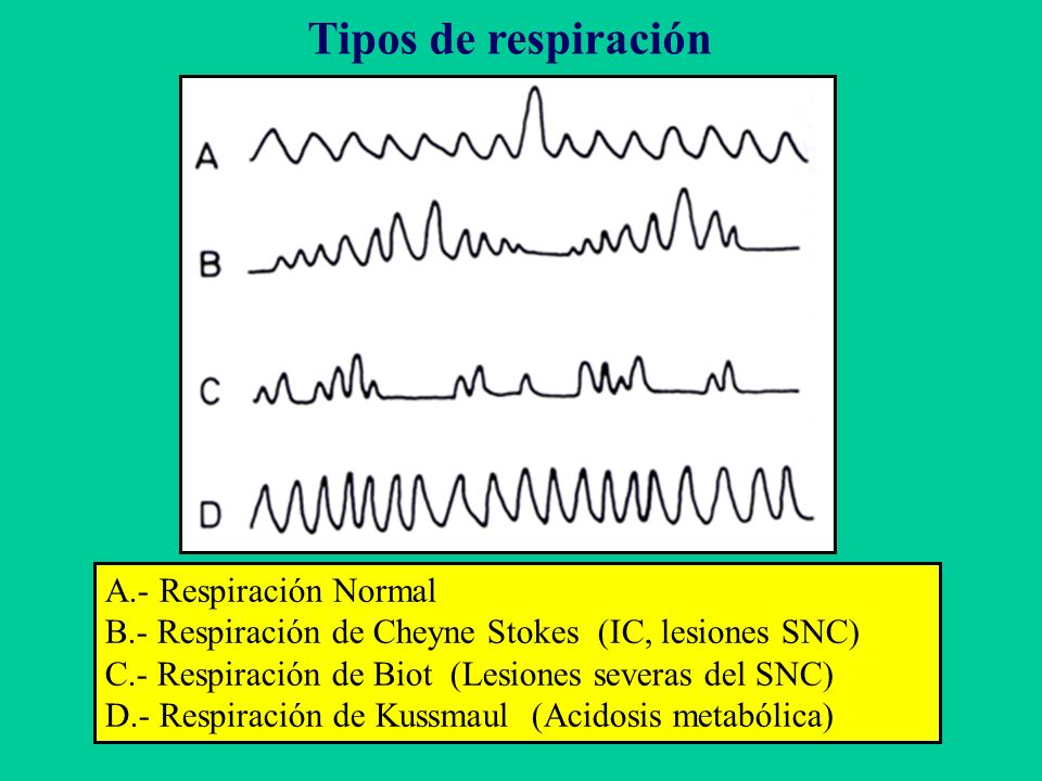 Tipos de respiración A.- Respiración Normal