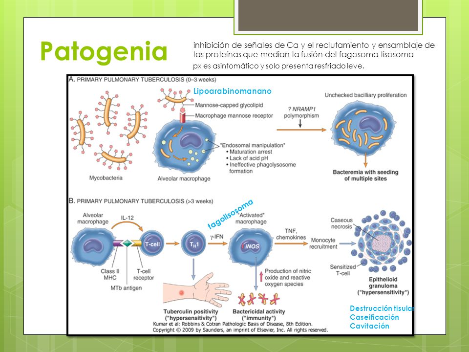 Patogenia inhibición de señales de Ca y el reclutamiento y ensamblaje de las proteínas que median la fusión del fagosoma-lisosoma.