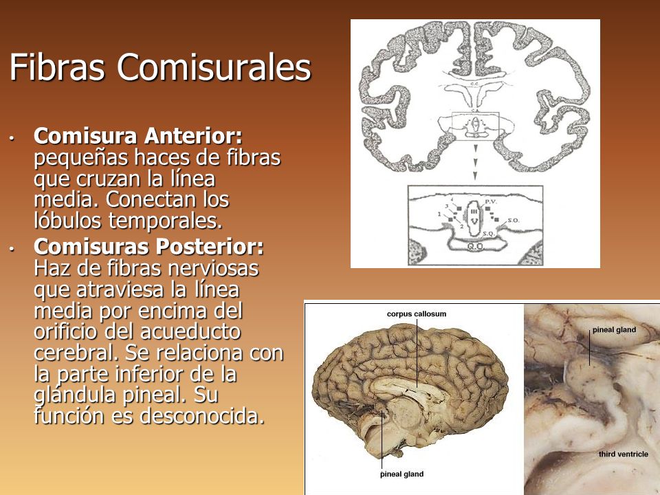 Fibras Comisurales Comisura Anterior: pequeñas haces de fibras que cruzan la línea media. Conectan los lóbulos temporales.