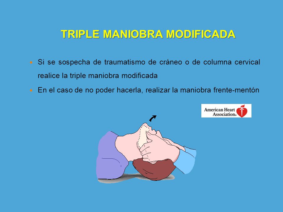 TRIPLE MANIOBRA MODIFICADA