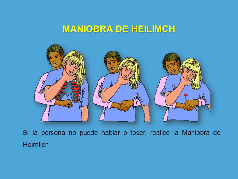 MANIOBRA DE HEILIMCH Si la persona no puede hablar o toser, realice la Maniobra de Heimlich