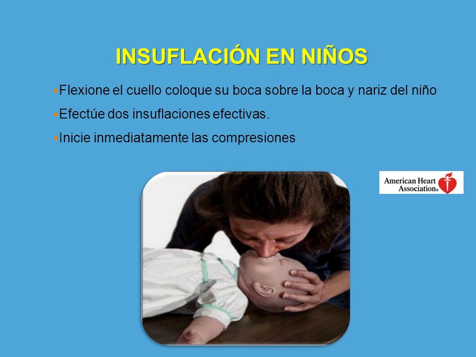 INSUFLACIÓN EN NIÑOS Flexione el cuello coloque su boca sobre la boca y nariz del niño. Efectúe dos insuflaciones efectivas.