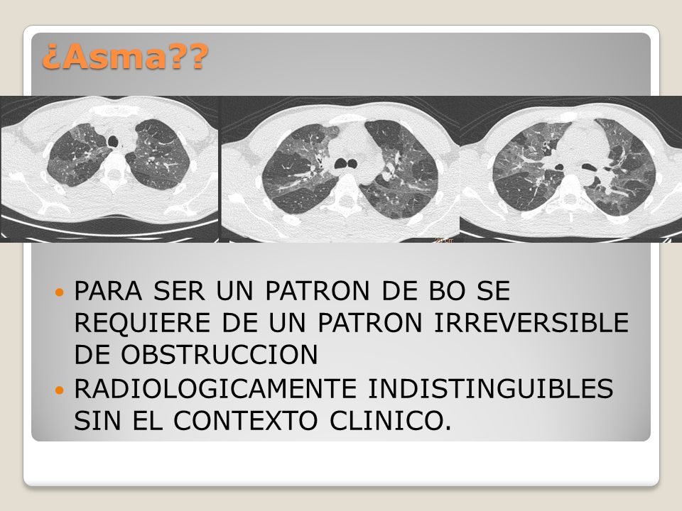 ¿Asma . PARA SER UN PATRON DE BO SE REQUIERE DE UN PATRON IRREVERSIBLE DE OBSTRUCCION.