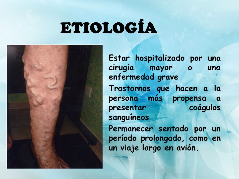 ETIOLOGÍA Estar hospitalizado por una cirugía mayor o una enfermedad grave.