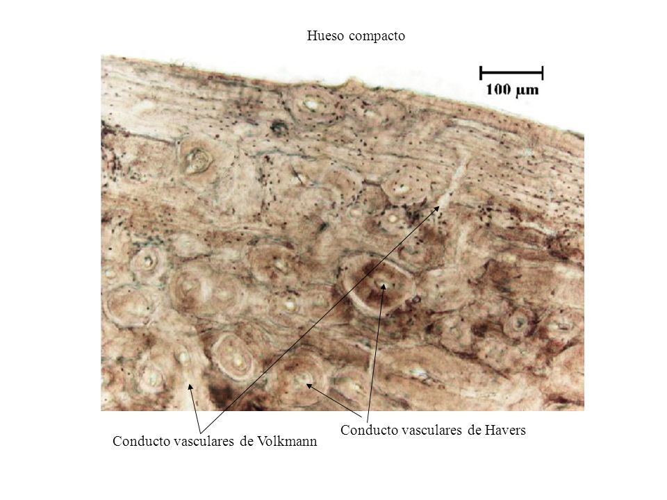Hueso compacto Conducto vasculares de Havers Conducto vasculares de Volkmann