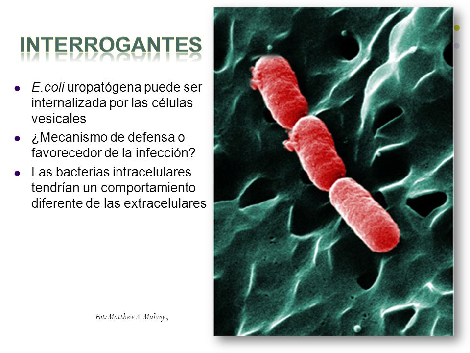 Interrogantes E.coli uropatógena puede ser internalizada por las células vesicales. ¿Mecanismo de defensa o favorecedor de la infección