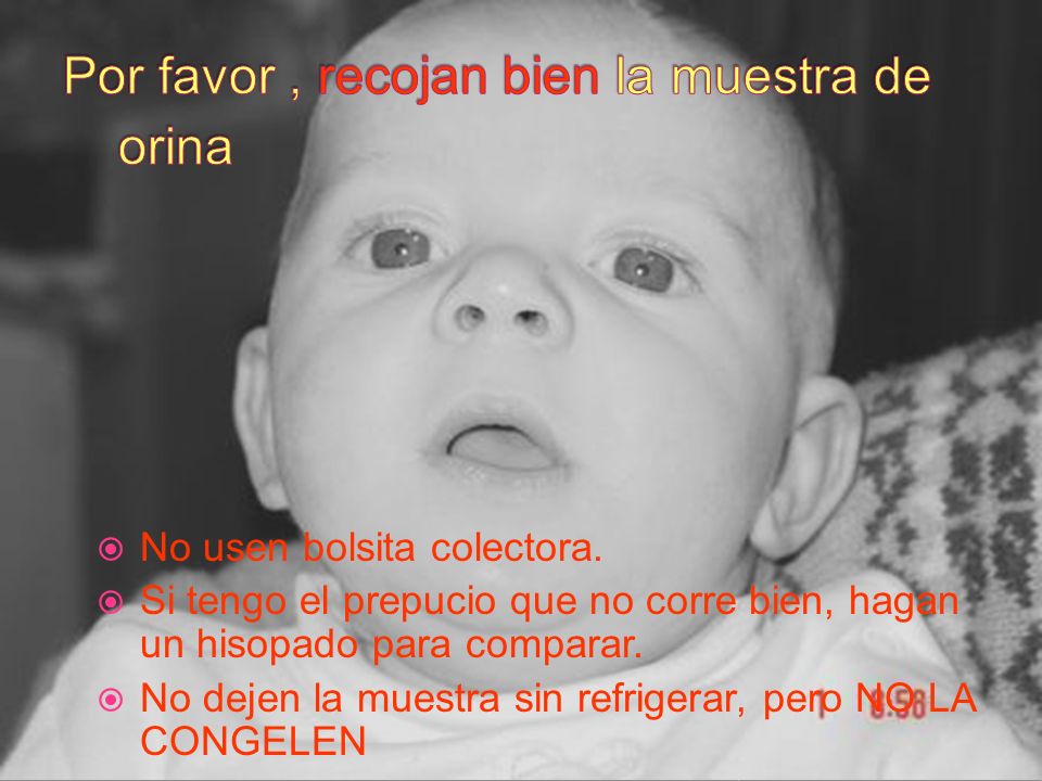 Por favor , recojan bien la muestra de orina