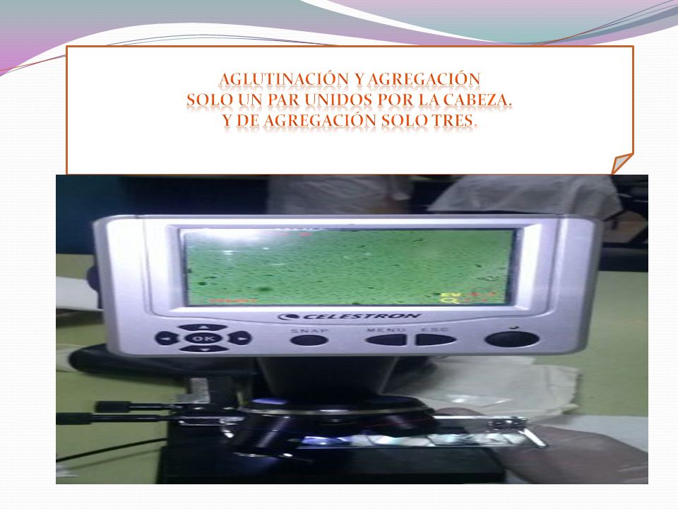 Aglutinación y Agregación Solo un par unidos por la cabeza.