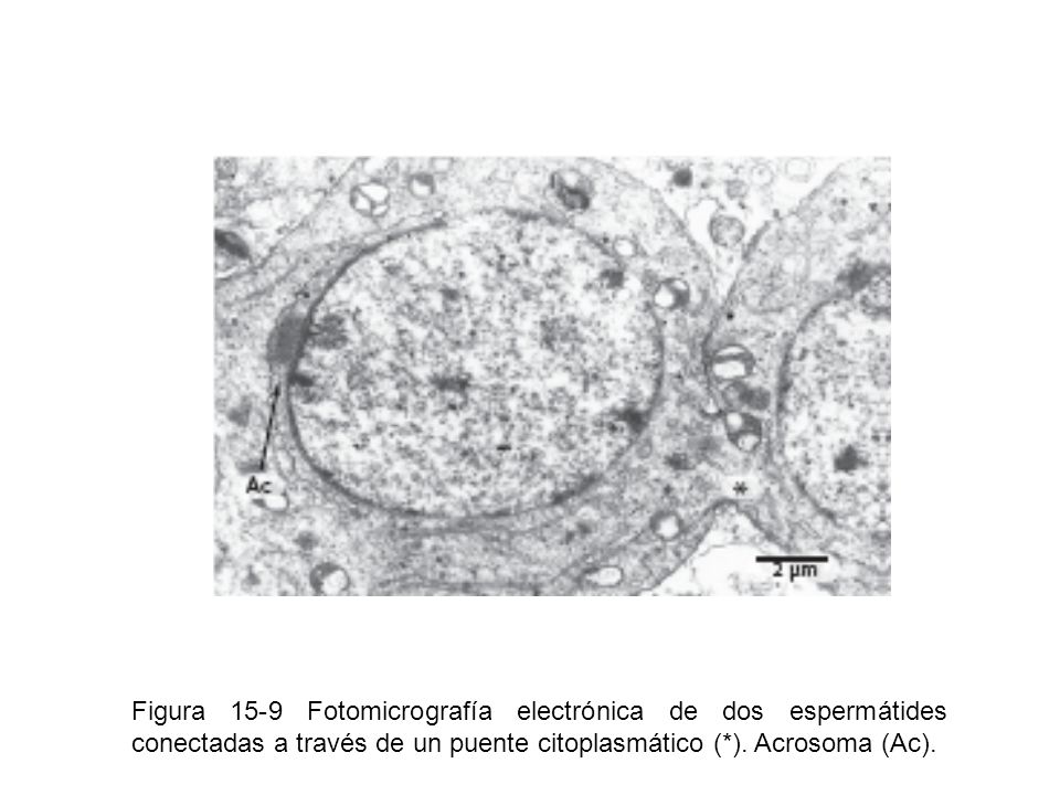 Figura 15-9 Fotomicrografía electrónica de dos espermátides conectadas a través de un puente citoplasmático (*).