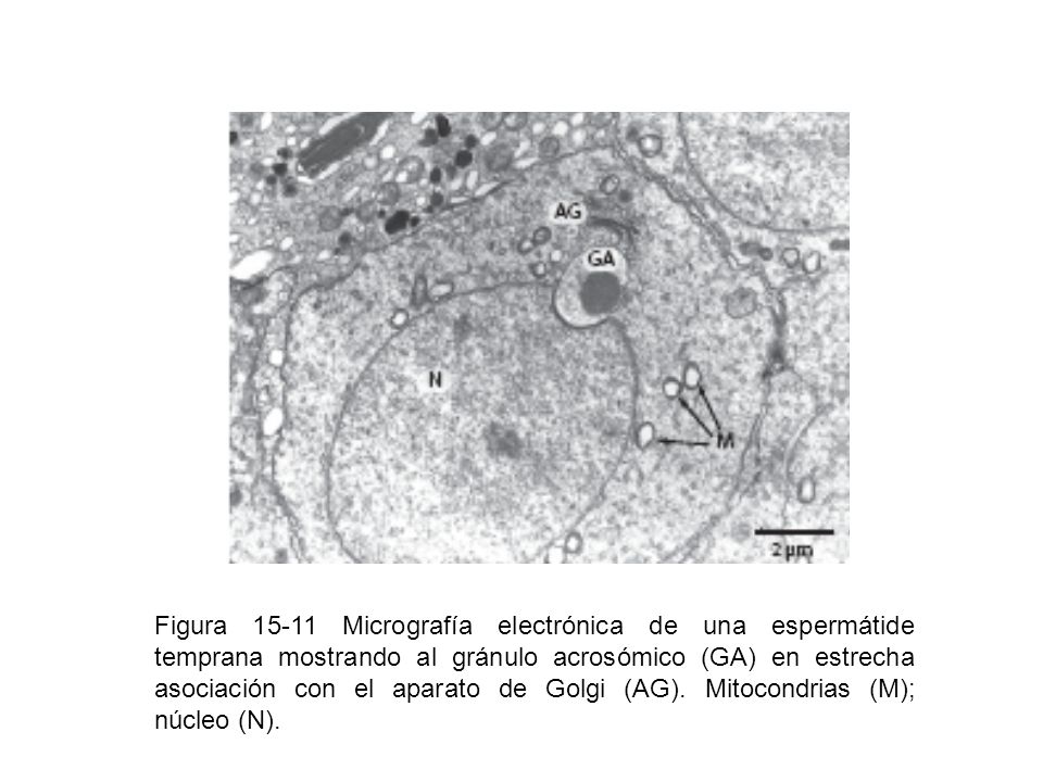 Figura Micrografía electrónica de una espermátide temprana mostrando al gránulo acrosómico (GA) en estrecha asociación con el aparato de Golgi (AG).
