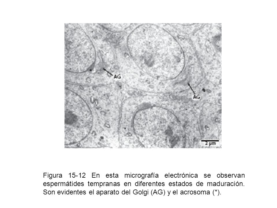 Figura En esta micrografía electrónica se observan espermátides tempranas en diferentes estados de maduración.