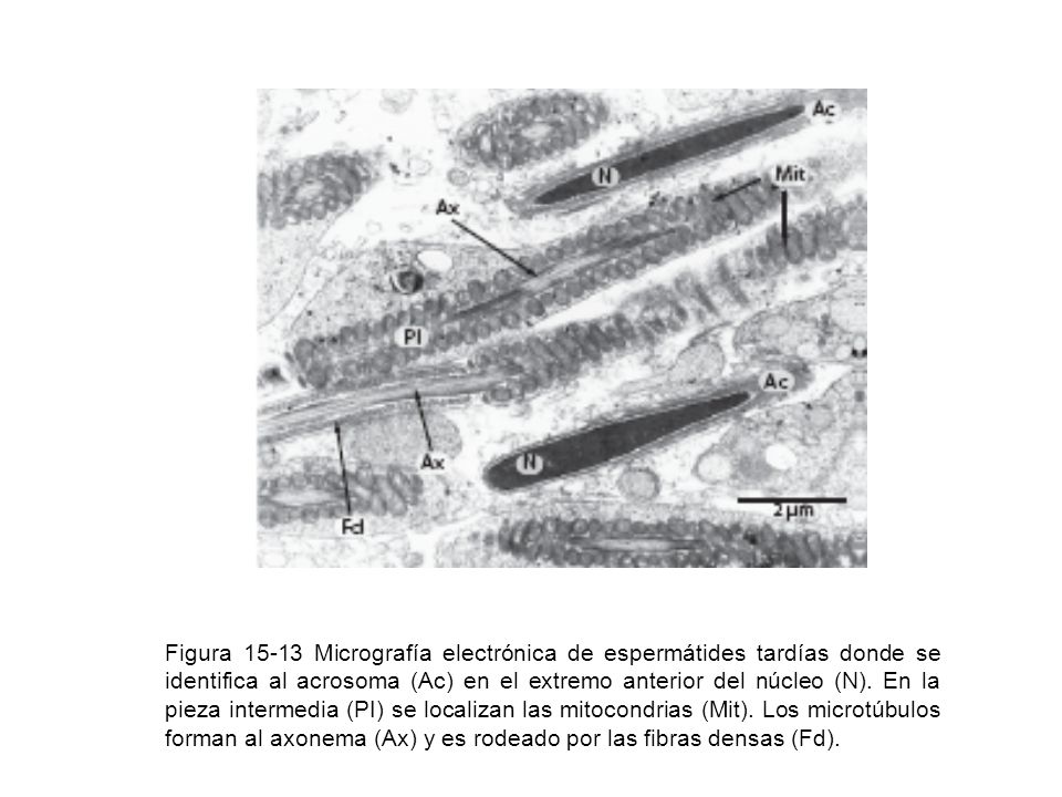Figura Micrografía electrónica de espermátides tardías donde se identifica al acrosoma (Ac) en el extremo anterior del núcleo (N).