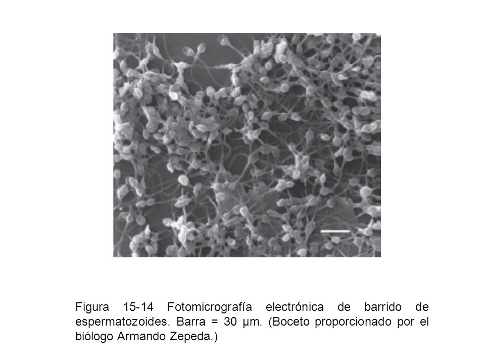 Figura Fotomicrografía electrónica de barrido de espermatozoides