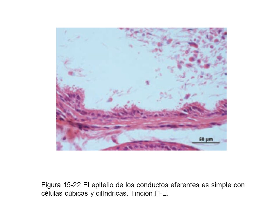 Figura El epitelio de los conductos eferentes es simple con células cúbicas y cilíndricas.