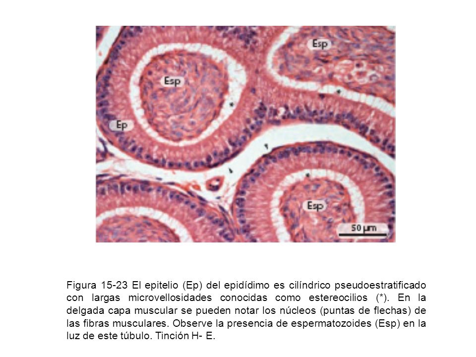 Figura El epitelio (Ep) del epidídimo es cilíndrico pseudoestratificado con largas microvellosidades conocidas como estereocilios (*).