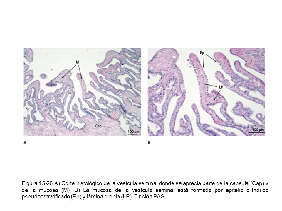 Figura A) Corte histológico de la vesícula seminal donde se aprecia parte de la cápsula (Cap) y de la mucosa (M).