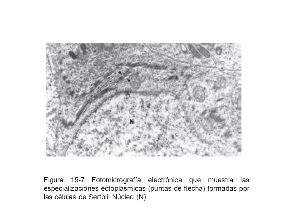 Figura 15-7 Fotomicrografía electrónica que muestra las especializaciones ectoplásmicas (puntas de flecha) formadas por las células de Sertoli.