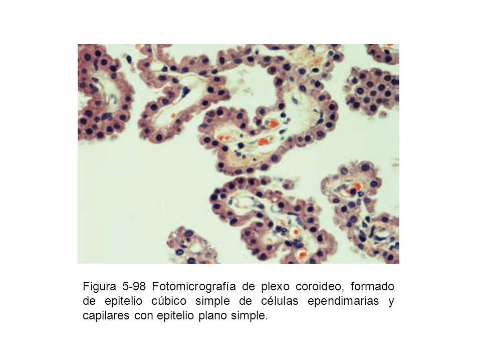 Figura 5-98 Fotomicrografía de plexo coroideo, formado de epitelio cúbico simple de células ependimarias y capilares con epitelio plano simple.