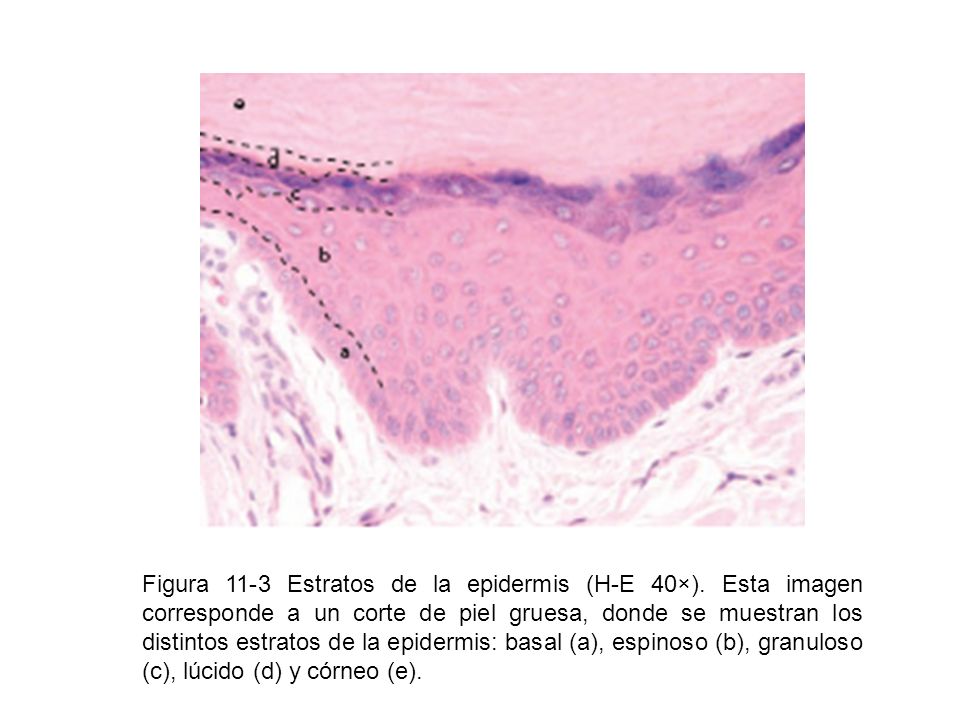 Figura 11-3 Estratos de la epidermis (H-E 40×)