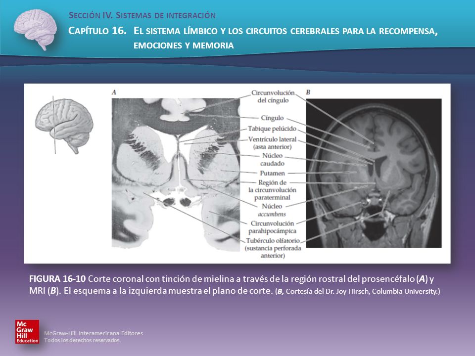 FIGURA Corte coronal con tinción de mielina a través de la región rostral del prosencéfalo (A) y MRI (B).