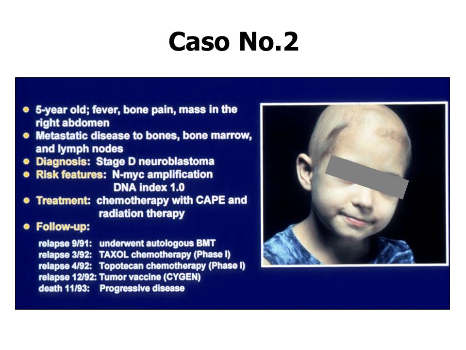 Caso No.2 5 años de edad, fiebre, dolor de hueso, una masa en el lado derecho del abdomen.
