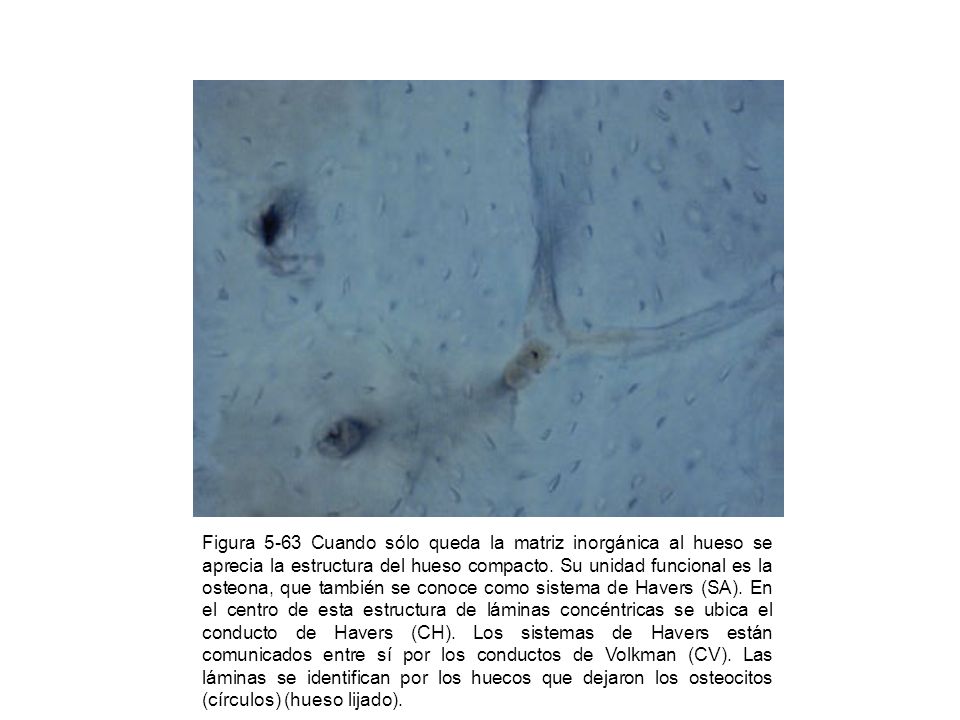 Figura 5-63 Cuando sólo queda la matriz inorgánica al hueso se aprecia la estructura del hueso compacto.