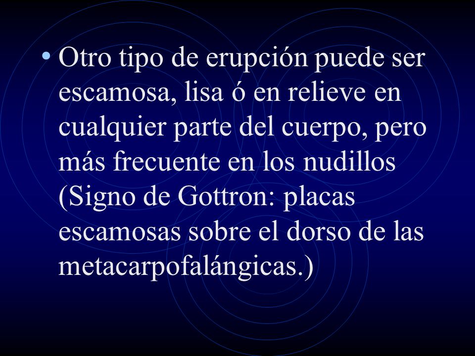 Otro tipo de erupción puede ser escamosa, lisa ó en relieve en cualquier parte del cuerpo, pero más frecuente en los nudillos (Signo de Gottron: placas escamosas sobre el dorso de las metacarpofalángicas.)