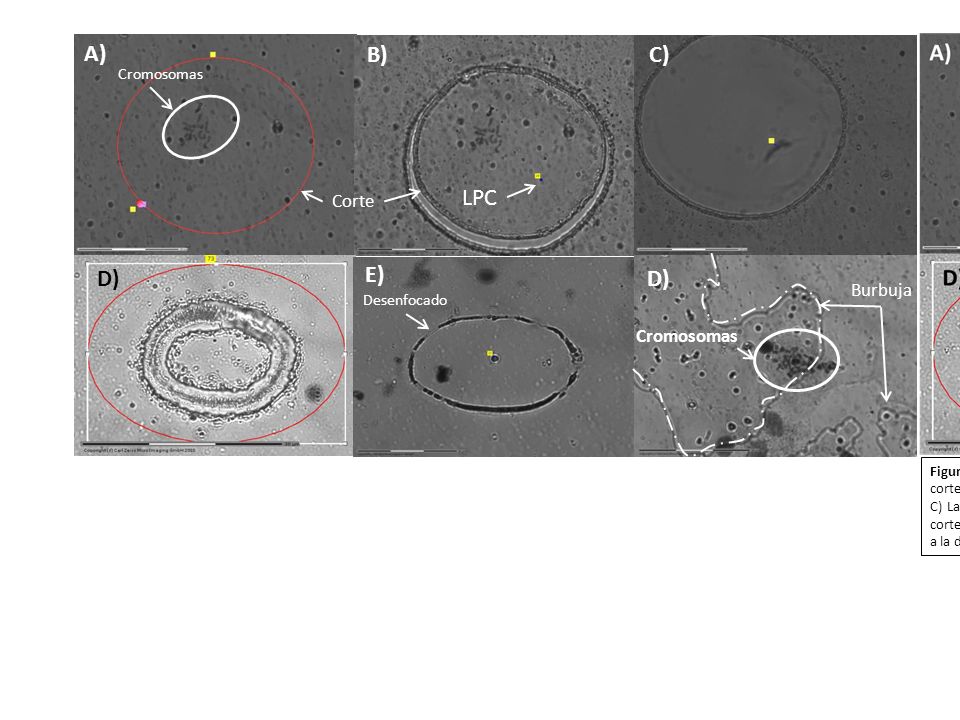 A) B) C) LPC D) E) Corte Burbuja Cromosomas Desenfocado