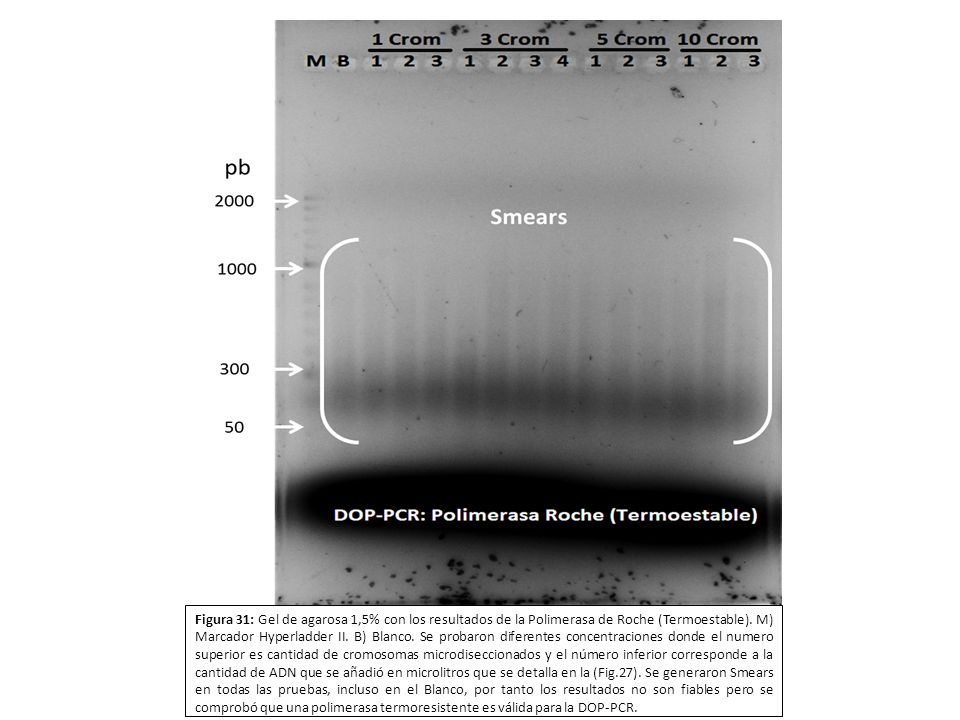 Figura 31: Gel de agarosa 1,5% con los resultados de la Polimerasa de Roche (Termoestable).