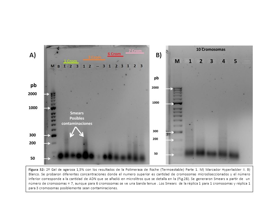 Figura 32: 2º Gel de agarosa 1,5% con los resultados de la Polimerasa de Roche (Termoestable) Parte 1. M) Marcador Hyperladder II. B) Blanco. Se probaron diferentes concentraciones donde el numero superior es cantidad de cromosomas microdiseccionados y el número inferior corresponde a la cantidad de ADN que se añadió en microlitros que se detalla en la (Fig.28). Se generaron Smears a partir de un número de cromosomas = 7, aunque para 6 cromosomas se ve una banda tenue . Los Smears de la réplica 1 para 1 cromosomas y réplica 1 para 3 cromosomas posiblemente sean contaminaciones.