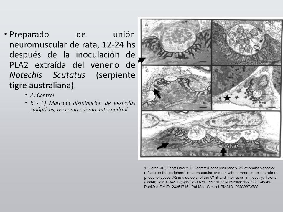 Preparado de unión neuromuscular de rata, hs después de la inoculación de PLA2 extraída del veneno de Notechis Scutatus (serpiente tigre australiana).
