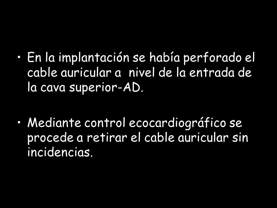 En la implantación se había perforado el cable auricular a nivel de la entrada de la cava superior-AD.